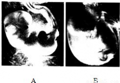 通过检测羊水中胚胎脱落的细胞.就可以知道胎儿的性别．因为女性和男性的遗